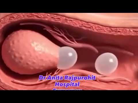 एक स पर म स बच च क स बनत ह द ख ड क टर अन त DoctorAnitaHospital StudentClickStudy Bihar