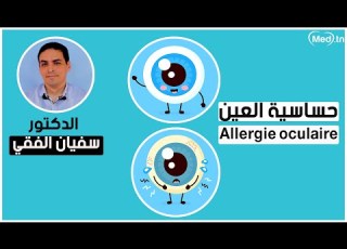 حساسية العين مع الدكتور سفيان الفقي