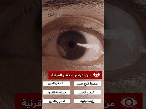 خدش القرنية القرنية اكسبلور Foryou Explore عيون