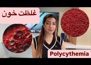غلظت خون علت علائم درمان پلی سیتمی Polycythemia
