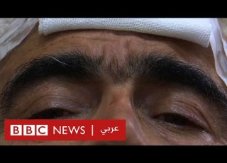 بي بي سي تلتقي جرحى الزلزال في حلب روايات تدمي القلوب