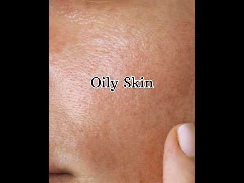 Homemade Facepack For Oily Skin Recipe For Oily Skin Shorts Oilyskin Skincare Beautytips Homemade Facepack For Oily Skin Recipe For Oily Skin Shorts Oilyskin Skincare Beautytips
