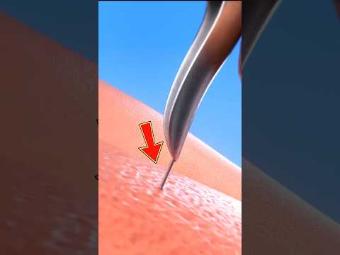 حذاري ما هو سر عمل آلات الوشم وكيف يتم الوشم حذاري ما هو سر عمل آلات الوشم وكيف يتم الوشم