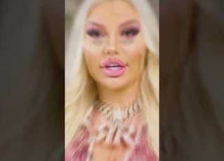 My First Surgery Was At 18 Now I Ve Spent 100K Ytshorts Hookedonthelook Plasticsurgery Rich