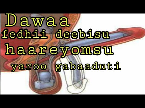 Das Medikament Zur Stärkung Des Schwachen Penis