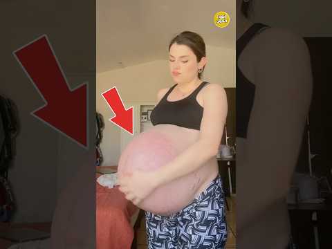 حمل بثلاثة توائم