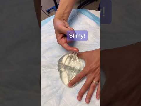 Was Passiert Wenn Sie Die Innenseite Eines Silikonimplantats Berühren Shorts Siliconeimplants