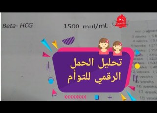 تحليل الحمل الرقمي للتوأم