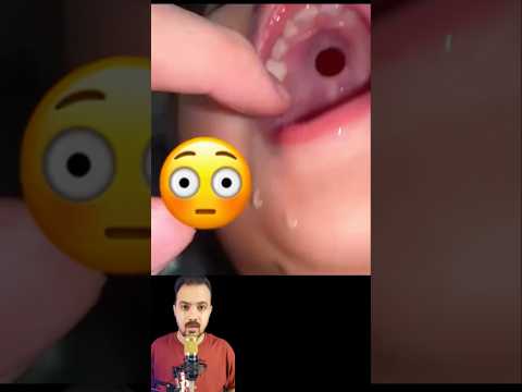 تعرف ايه ده