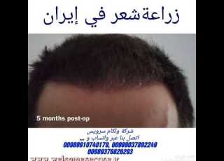  منسق وقت الجراحة خدمات ترجمة نقل و فندق في إيران