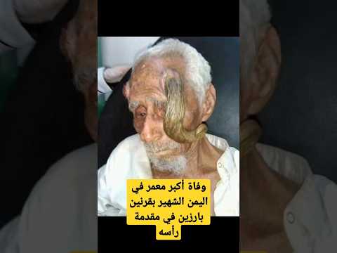 The Oldest Man In Yemen Famous For The Two Prominent Horns On His Forehead Has Died Shorts
