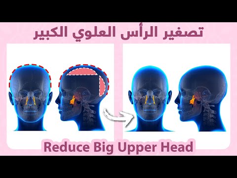 Reduce Big Upper Head Fix Flat Head تقليل حجم الرأس العلوي حل مشكلة شكل الرأس المسطح