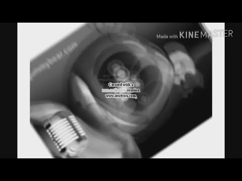 KlaskyKlaskyKlaskyKlasky Gummy Bear Song Version Effects By Arkin Tongco In Low Voice