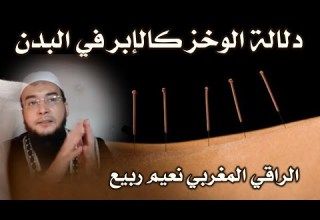 خطييير جدااا دلالة الإحساس بالوخز كالإبر في البدن الراقي المغربي نعيم ربيع