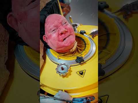 A Man On A Ventilator For 70 Years