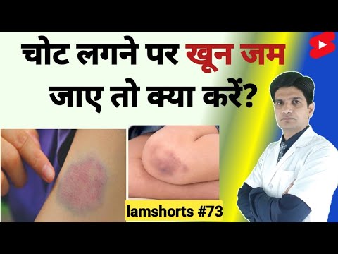What To Do If The Blood Clots After An Injury Shorts Lamshorts