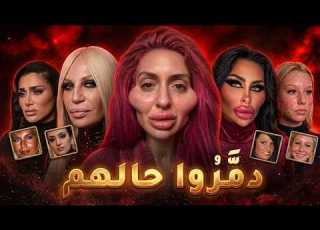  أسوأ وأخطر تجارب تجميل عملوها المشاهير 6