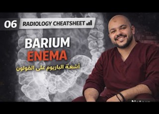6 BARIUM ENEMA اشعه الباريوم علي القولون