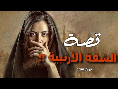 2056 قصة الشفة الأرنبية