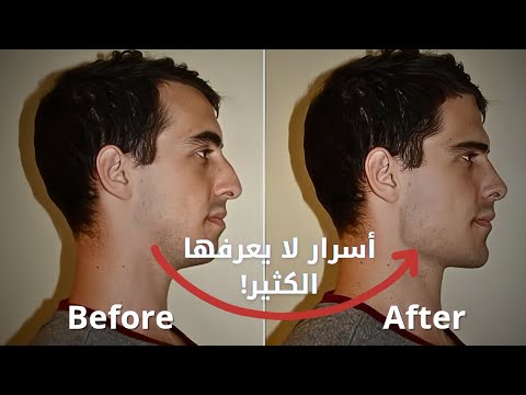 How To Attractive Jawline