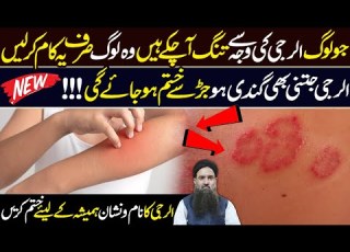 Elergy Ka Ilaj Sirf Ye Kam Kar Lo Aur Elergy Sy Hamesha Chutkara Pao Dr Sharafat Ali Latest