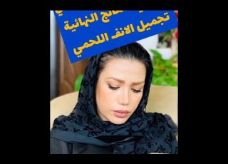 أفضل دكتور تجميل الأنف اللحمي في ايران وداع ا للأنف الكبير
