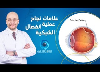 Signs Of Successful Retinal Detachment Surgery Dr Ahmed Habib