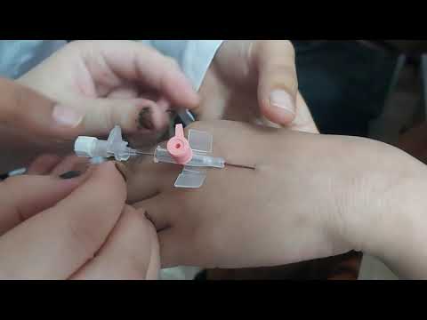 كانيولا بيد الممرضة الحنونة سهلة وخفيفة بدون الم كانيولا بيد الممرضة الحنونة سهلة وخفيفة بدون الم