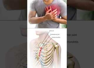 Xabad Xanuun Jucis U Baahan