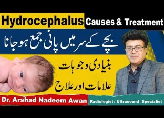  Hydrocephalus Causes Symptoms And Treatment In Urdu