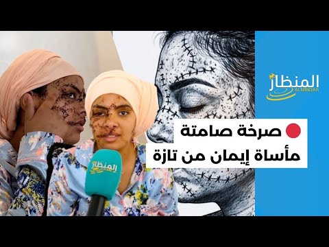 بين الاغتصـ اب والتشـ ويه إيمان من تازة تروي قصتها مع طليقها التي صدم ـ ت الرأي العام بين الاغتصـ اب والتشـ ويه إيمان من تازة تروي قصتها مع طليقها التي صدم ـ ت الرأي العام