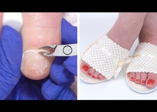  The Best Foot Treatment Ever Amazing Feet Shorts