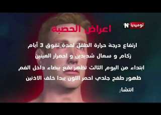 الحصبة أو بوحمرون هذه الأعراضها وكيفية الوقاية