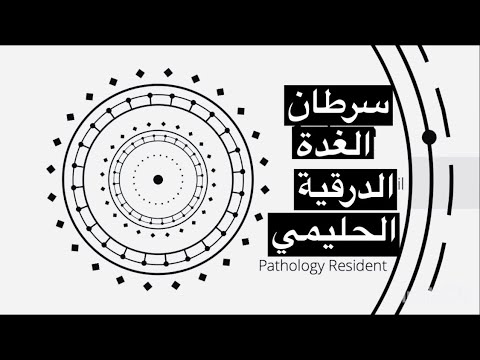 سرطان الغدة الدرقية الحليمي Papillary Thyroid Carcinoma