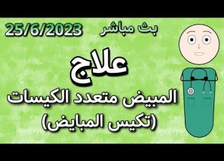  علاج المبيض متعدد الكيسات