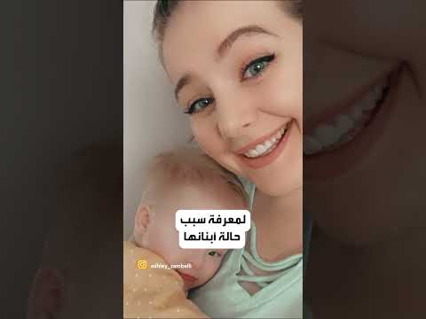 فتاة تكتشف إصابتها بمتلازمة داون وهي في عمر ال23 عاما