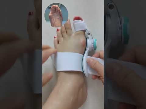 علاج عظم الرجل البارز