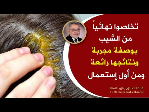 أفضل طرق التخلص من الشيب وازالة الشيب من الشعر نهائيا حتى لوكان الشعر يغزوه الشعر الأبيض نتائج مبهرة