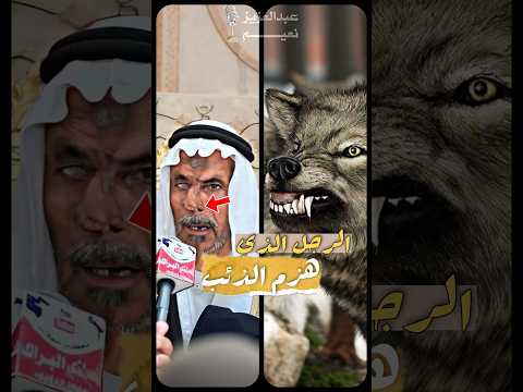 هجم عليه الذئب وأكل انفه ولكن
