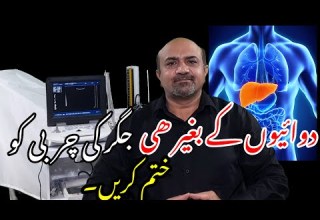 How To Naturally Manage Fatty Liver Disease Dawai Kay Baghair Jiggar Ki Charbi Ka Ilaj