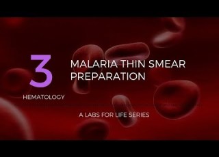  Malaria Thin Smear Preparation