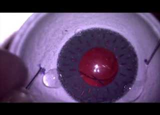  Yamane Technique On SimulEYE Model