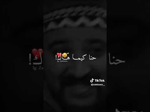 أغنية سكاتش البطحة حنا كيما هاك