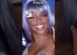  Did Lil Kim Have Plastic Surgery