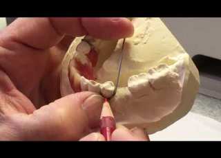  Wire Bending A Clasp