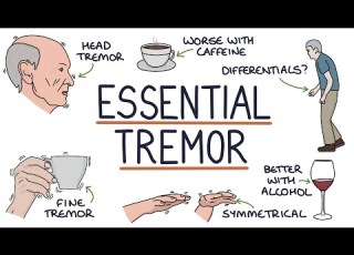 Understanding Benign Essential Tremor