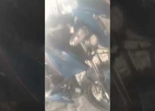  Ekisi Dent Ho Gaya Hai Yaar