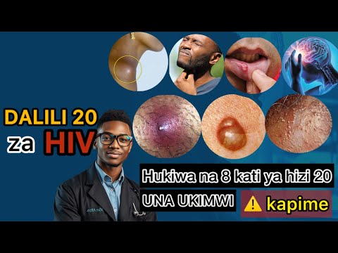 Jipime UKIMWI Kwa Hizi Dalili 20 Dalili 20 Za UKIMWI Za Mwanzoni Wiki Ya 2 4