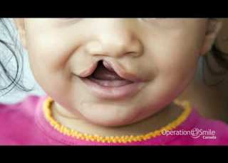  A Future Of Smiles 15 Sec