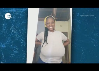  Your Breasts Look A Little Too Large For Your Age Pauline Transformational Breast Surgery Journey